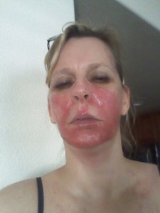 Cancer Treatment Side Effect 2